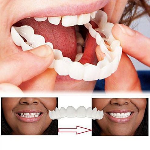 Explorez le Monde des Dents Artificielles : Sourire avec Confiance et Confort