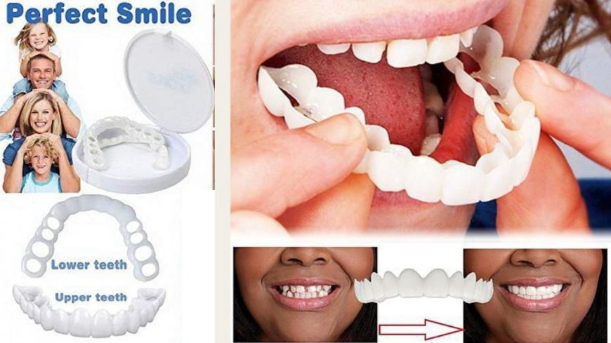 Explorez le Monde des Dents Artificielles : Sourire avec Confiance et Confort